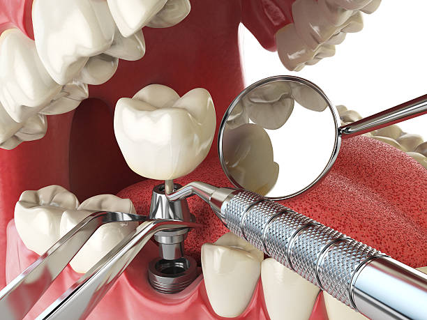 Tooth Infection Emergency Dentist in KY